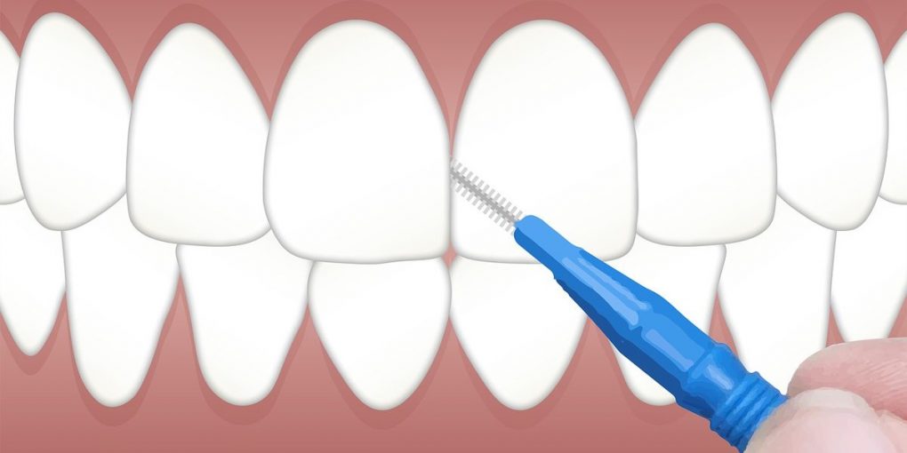 Anwendung interdental Bürste Illustration